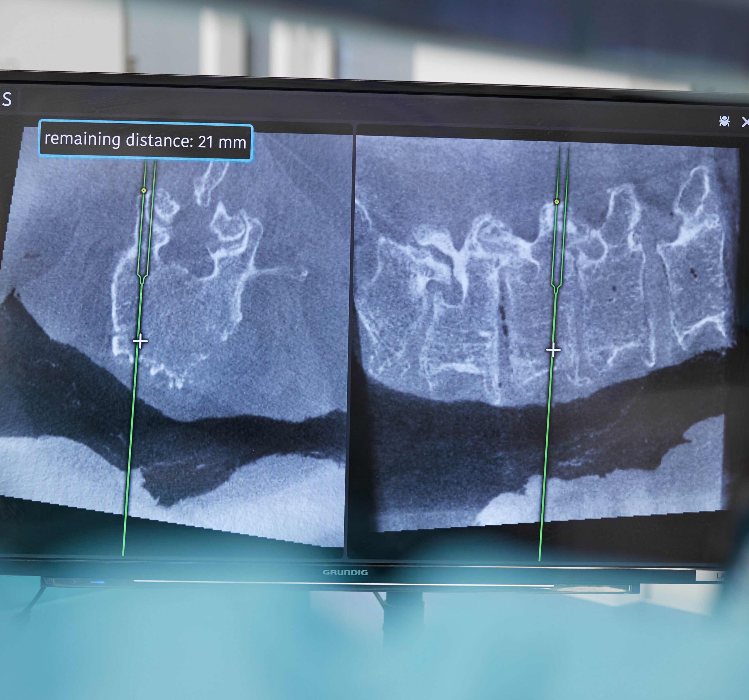 Surgical navigation displayed on standard imaging equipment
